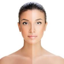 Detan Treatment for Even Skin Tone